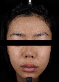 피부 밝기 대표 사진 — 사용 전, 검은 배경 정면 얼굴(눈 가림)
