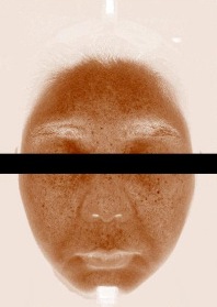 피부 멜라닌양 대표 사진 — 2주 사용 후, 멜라닌 분포 영상(눈 가림)
