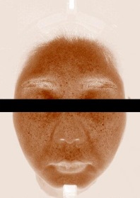피부 멜라닌양 대표 사진 — 사용 전, 멜라닌 분포 영상(눈 가림)